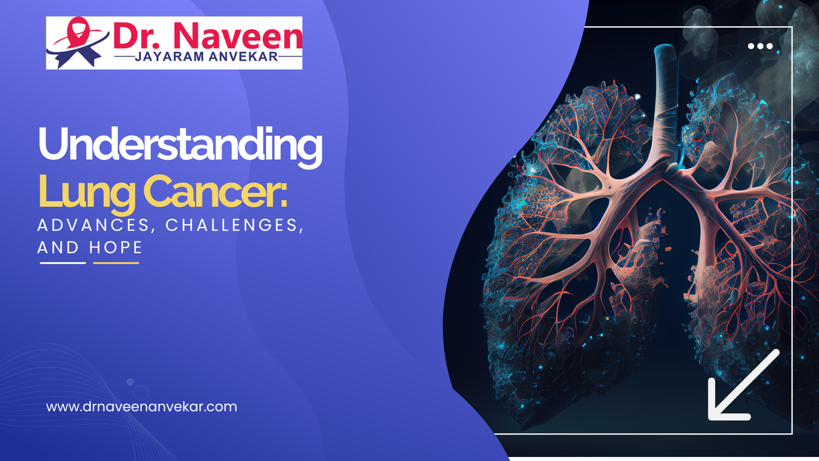 Understanding Lung Cancer: Advances, Challenges, and Hope